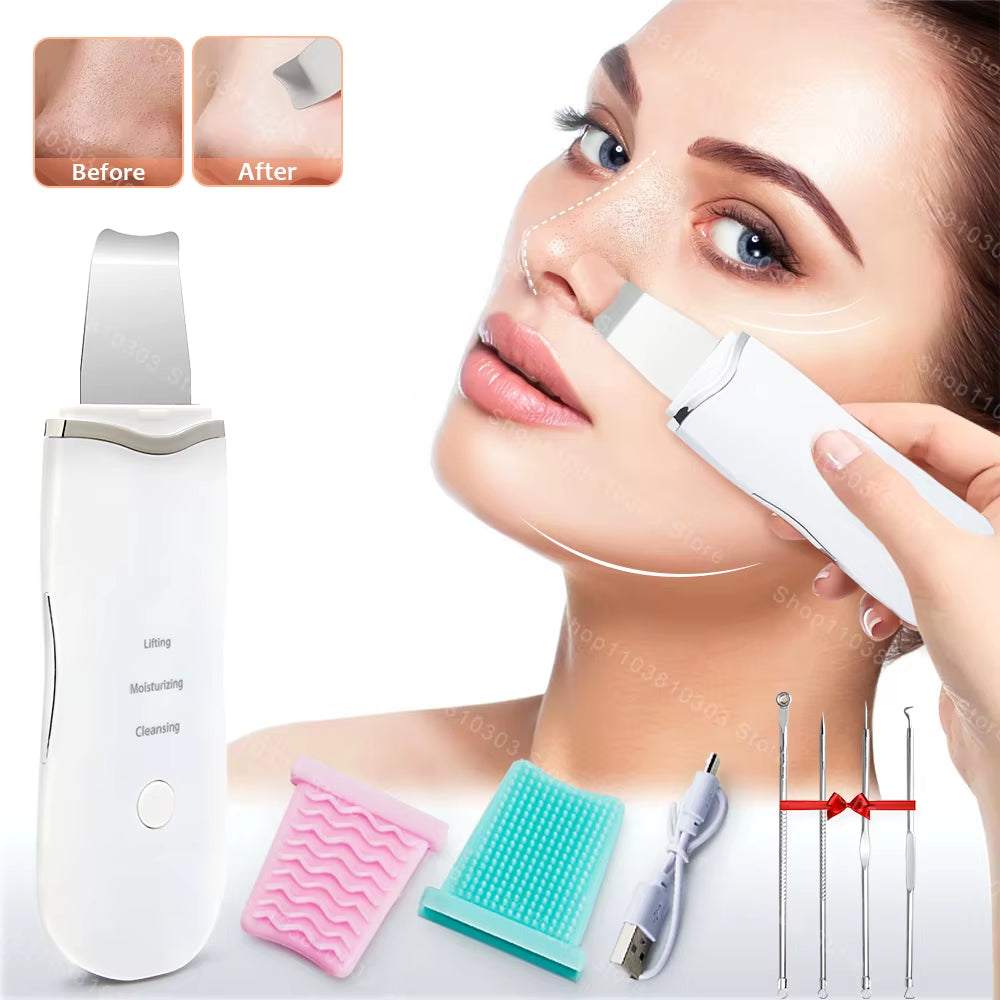 Electric Ultrasonic Face Scrubber