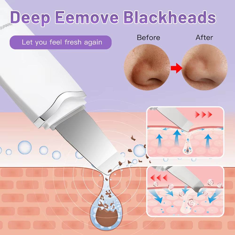 Electric Ultrasonic Face Scrubber